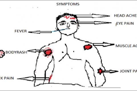 Symptoms of dengue